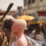 Burundi: tuée parce que albinos