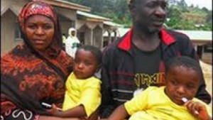Cameroun: Des bébé siamois changent le regard d’un village